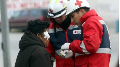 La lesión más grave es en el ojo derecho.