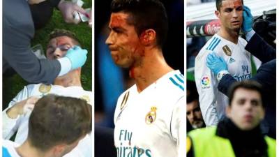 Además de la goleada de 7- al Deportivo con doblete de Cristiano, el crack luso dejó una nota curiosa luego de haber recibido un terrible golpe en su rostro y llegó al extremo de usar hasta un celular para verse.