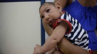 Los casos sospechosos de microcefalia en niños de Brasil aumentaron 6.43% en una semana.