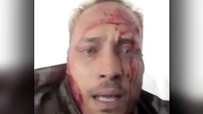 Captura del video de Oscar Pérez cuando era atacado por agentes venezolanos.