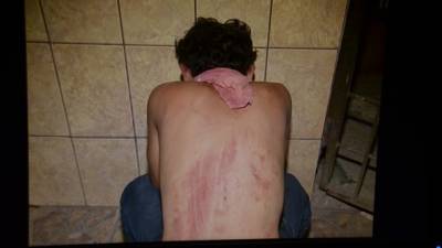 El joven afectado fue rescatado por la Policía antes de que sus captores lo asesinaran; aseguró que fue torturado.