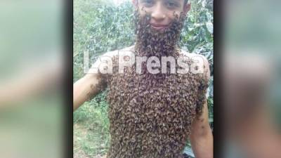 Emerson Rodríguez es un joven hondureño ha llegado a llenar su cuerpo con miles de abejas.