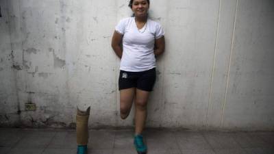 Angie, de quince años, pisó una mina cuando tenía ocho regresando de misa.