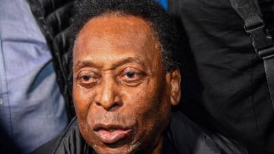 El Rey Pelé cuenta con 82 años de edad.