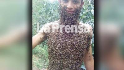 Emerson Rodríguez es un joven que se ha hecho viral en las redes luego de dar a conocer su pasión por las abejas y la apicultura a través de Diario LA PRENSA.
