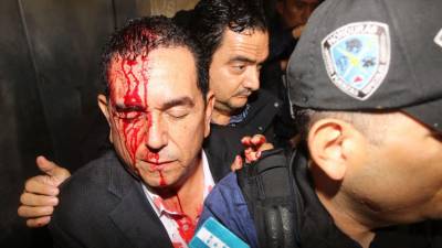 El diputado nacionalista Antonio Rivera Callejas fue agredido en la cabeza por colectivos de Libre.