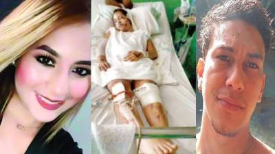 La joven sufrió heridas de gravedad.