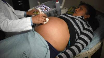 La recomendación de la ONU de autorizar el aborto por el zika genera controversias en América Latina. Foto: AFP/