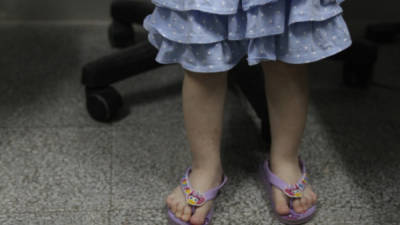 Los pies de la niña que sus padres intentaban vender. Foto: Roberto Ramos / DP / D.Â Press