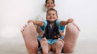 El venezolano Jeison Orlando Rodríguez Hernández tiene los pies más grandes del mundo. 40.1 cm mide su pie derecho, y 39.6 cm el izquierdo.
