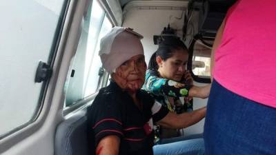 Una de las ancianas macheteadas al momento de ser atendida en una ambulancia.