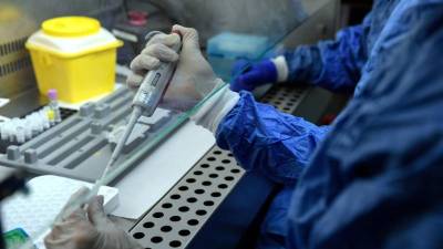 El ensayo de los NIH se inició el 21 de febrero. Foto: AFP/Referencia