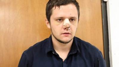 'El Menchito' fue capturado en un operativo de la Marina mexicana. El joven se realizó una cirugía en su rostro.