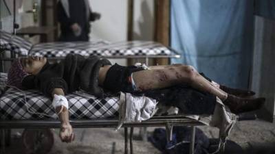 Un niño recibe tratamiento en un hospital tras los bombardeos en Douma, a las afueras de Damasco. EFE/Archivo.