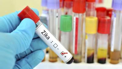 Siguen realizándose investigaciones para buscar una vacuna contra el zika.