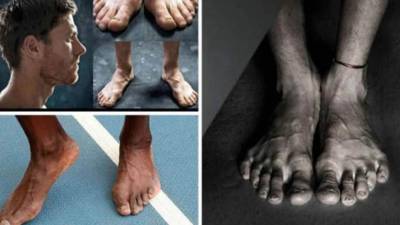 Es algo en lo que casi nadie se fija, pero sin duda que es tema interesante para cualquier persona. ¿Han visto ustedes los pies más feos de los deportistas más famosos del mundo? Pues aquí haremos un recuento de ello.