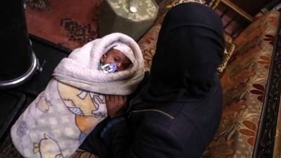 El pequeño Karim perdió un ojo cuando tenía 40 días de vida tras un bombardeo.// EFE/ Mohammed Badra