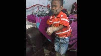 Esta foto del menor atado de manos y pies ha conmocionado a los usuarios en las redes sociales.