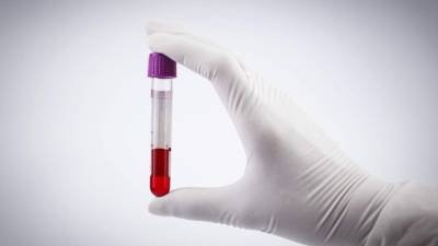 Los investigadores usaron un nuevo escáner genético conocido como Guardant360, que analiza el ADN.