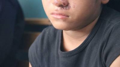 Menor que sufría maltrato de su familia en Santa Bárbara.