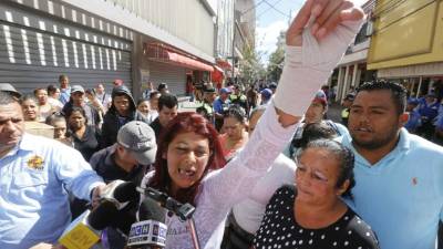 Una explica la situación de los vendedores ambulantes. Foto del miércoles 21 de diciembre de 2016 en Tegucigalpa.