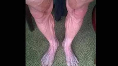 La foto de su piernas tomada por el polaco Bartosz Huzarski se convirtió en un boom en la redes sociales.