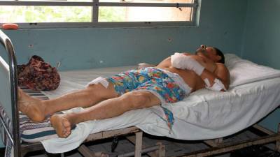 El paciente está en la sala de ortopedia del Mario Catarino Rivas.