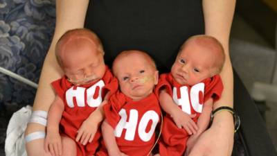 Con apenas tres meses de edad los trillizos fueron operados por los médicos para retirarles los pequeños tumores que se formaban en sus ojos.