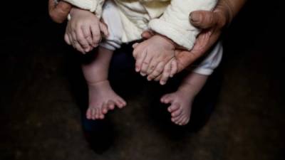El niño tiene 15 dedos en sus manos y 16 en los pies. Fotos: getty images