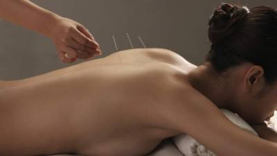 La acupuntura se usa para controlar el dolor de espalda.