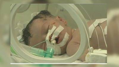 La niña tiene un 50% de probabilidades de sobrevivir, según los médicos.