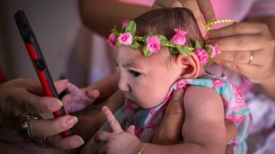 Brasil es el país con más casos de microcefalia. Foto: EFE/Percio Campos