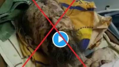 Las versiones sobre 'la historia del hombre atacado por un oso' se multiplicaron.