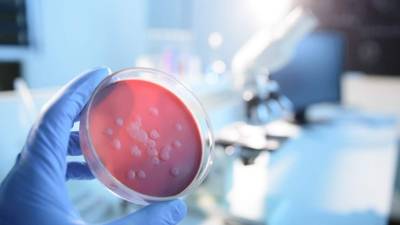 Scientist examining a microbiological culture