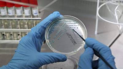 Los CDC urgieron a los centros médicos a aislar 'rápidamente' a estos pacientes e iniciar un control de la infección 'agresivo'.