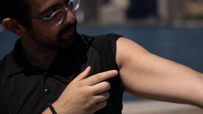 Kyle Planck, de 26 años de edad, se acaba de recuperar de la viruela del mono y afirma que sufrió los peores dolores de su vida con la enfermedad.