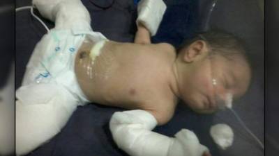 El niño goza de buena salud, informaron los doctores.