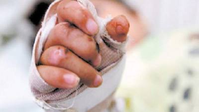 Según explicó Dinaf, este es un caso de reincidencia, pues el menor ha recibido otras agresiones con anterioridad. (Imagen de referencia)