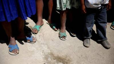 Según estadísticas del Sistema de Información Nacional de Seguridad Alimentaria y Nutricional (Sinsan), las muertes se redujeron en 29,3 % en relación al mismo periodo del año pasado, cuando se confirmaron 53 fallecimientos. EFE/Archivo