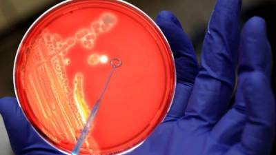 Un asistente de laboratorio examina una colonia de bacterias Escherichia coli. EFE/Archivo