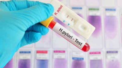 Helicobacter pylori (H. pylori) testing by using rapid test kit