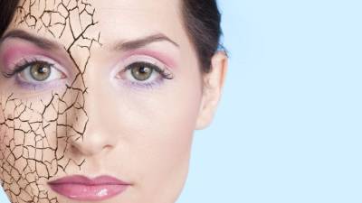 La deshidratación es la peor enemiga de este tipo de piel.