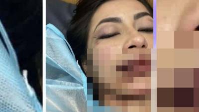 La colombiana Daniela Aldana fue supuestamente agredida por su novio Isaac Sandoval, lo que ha causado indignación en las redes sociales.