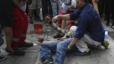 Varios manifestantes resultaron gravemente heridos en enfrentamientos con la policía guatemalteca./AFP.