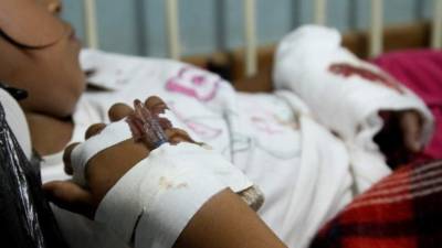 Siguen reportándose quemados por pólvora.