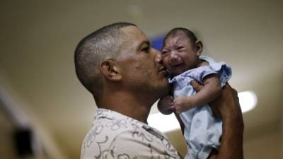 Brasil ha registrado más de 1,000 casos de recién nacidos con microcefalia.