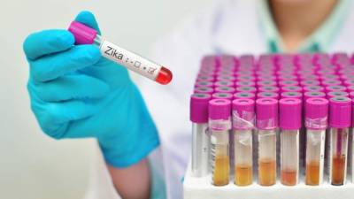 Blood sample positive with Zika virus