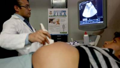 Las autoridades recomiendan a las mujeres acudir a control prenatal para que esten al tanto del crecimiento de sus bebés. Foto: EFE/Esteban Biba