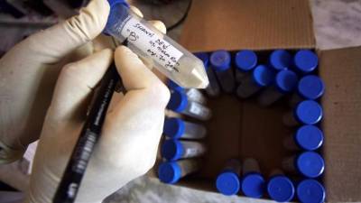 El representante de la OPS apuntó que alrededor de 1,4 millones de personas mueren en el mundo a consecuencia de esta enfermedad y que un total de 25.000 personas murieron en América en 2015 por tuberculosis. EFE/Archivo