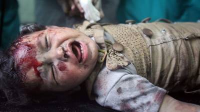 Los niños son los que más sufren en los combates entre Israel y Palestina.